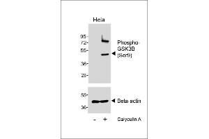 Western blot analysis of lysates from Hela cell line, untreated or treated with Calyculin A, 100nM, 30 min, using Phospho--GSK3B (Ser9) Antibody (upper) or Beta-actin (lower).