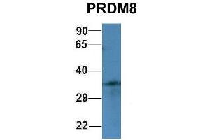 Host:  Rabbit  Target Name:  PRDM8  Sample Type:  293T  Antibody Dilution:  1. (PRDM8 antibody  (N-Term))