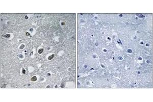 Immunohistochemistry analysis of paraffin-embedded human brain tissue, using MARCH4 Antibody. (MARCH4 antibody  (AA 301-350))