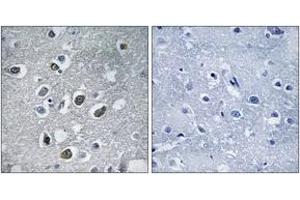 Immunohistochemistry (IHC) image for anti-Membrane-Associated Ring Finger (C3HC4) 4, E3 Ubiquitin Protein Ligase (MARCH4) (AA 301-350) antibody (ABIN1534862)