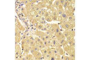 Immunohistochemistry of paraffin-embedded human liver injury using TRAF3IP2 Antibody (ABIN5974104) at dilution of 1/100 (40x lens). (TRAF3IP2 antibody)