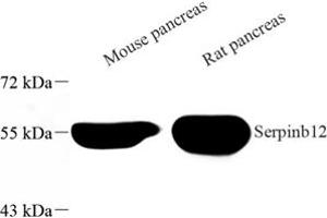 Western blot analysis of Serpinb12 (ABIN7075568) at dilution of 1: 500 (SERPINB12 antibody)