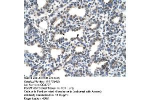 Human Lung (KCTD6 antibody  (N-Term))
