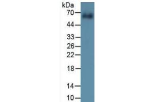 Mouse Capture antibody from the kit in WB with Positive Control: Sample Human cartilage tissue. (COL10 ELISA Kit)