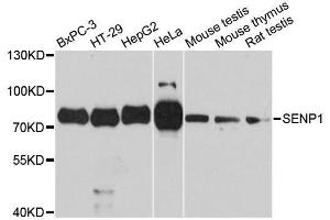 Western blot analysis of extracts of various cell lines, using SENP1 antibody. (SENP1 antibody  (AA 220-420))