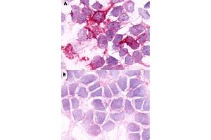 Immunocytochemical staining of HEK293 human embryonic kidney cells transfected (A) and untransfected (B) with BDKRB2. (BDKRB2 antibody  (C-Term))