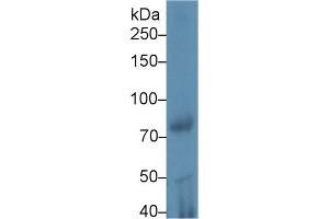 Western blot analysis of Rat Testis lysate, using Mouse iPLA2 Antibody (1 µg/ml) and HRP-conjugated Goat Anti-Rabbit antibody ( (PNPLA2 antibody  (AA 481-702))
