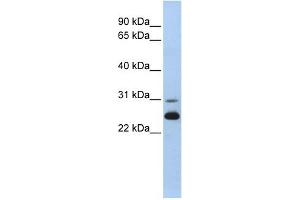 AK1 antibody used at 1 ug/ml to detect target protein. (Adenylate Kinase 1 antibody  (N-Term))