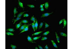 Immunofluorescent analysis of Hela cells using ABIN7151346 at dilution of 1:100 and Alexa Fluor 488-congugated AffiniPure Goat Anti-Rabbit IgG(H+L) (EML2 antibody  (AA 1-418))
