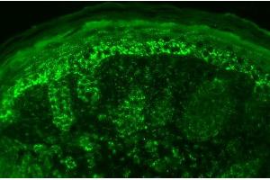 Immunohistochemistry analysis using Rabbit Anti-Cpn10 Polyclonal Antibody . (HSPE1 antibody  (AA 91-101) (FITC))