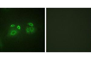 Peptide - +Immunofluorescence analysis of A549 cells, using Arrestin 1 (Ab-412) antibody. (SAG antibody  (Ser412))