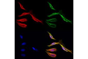 ABIN6262297 and ABIN6276874 staining Hela cells by IF/ICC.