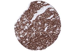 Parathyroid Parathyroid gland showing intense cytoplasmic PTH immunostaining of all glandular cells (Recombinant PTH antibody  (AA 1-34))