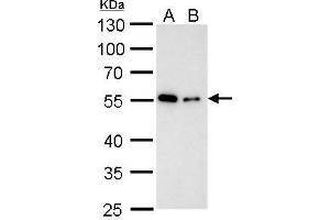 WB Image Alpha Tubulin antibody detects alpha Tubulin protein by western blot analysis. (TUBA1B antibody)