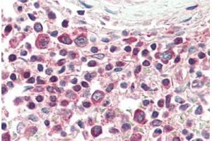 Human Spleen (formalin-fixed, paraffin-embedded) stained with TNFSF13 antibody ABIN461884 at 10 ug/ml followed by biotinylated goat anti-rabbit IgG secondary antibody ABIN481713, alkaline phosphatase-streptavidin and chromogen. (TNFSF13 antibody  (Extracellular Domain))