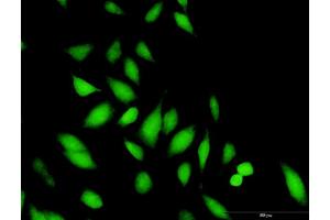 Immunofluorescence of purified MaxPab antibody to STAP1 on HeLa cell.