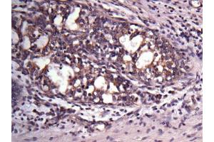 Immunohistochemistry (IHC) image for anti-VAMP (Vesicle-Associated Membrane Protein)-Associated Protein A, 33kDa (VAPA) antibody (ABIN2856826)
