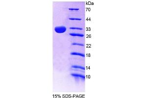 SDS-PAGE (SDS) image for Sepiapterin Reductase (SPR) (AA 1-261) protein (His tag) (ABIN6237537)