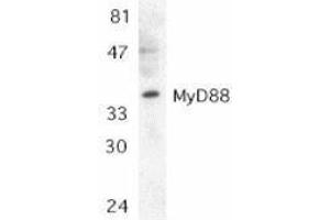 Western Blotting (WB) image for anti-Myeloid Differentiation Primary Response Gene (88) (MYD88) (AA 279-296) antibody (ABIN2475775) (MYD88 antibody  (AA 279-296))