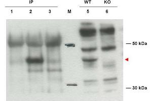 Image no. 1 for anti-Diaphanous Homolog 2 (DIAPH2) (AA 1085-1101), (Isoform 2) antibody (ABIN401289) (DIAPH2 antibody  (Isoform 2))