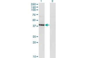 Western Blot analysis of HDAC8 expression in transfected 293T cell line by HDAC8 monoclonal antibody (M07), clone 2F4. (HDAC8 antibody  (AA 1-100))