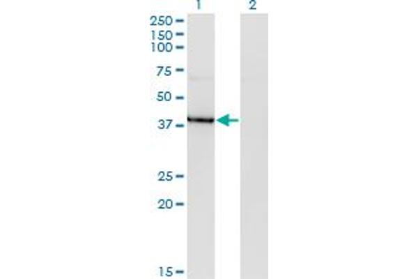 HDAC8 antibody  (AA 1-100)