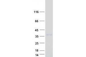 Validation with Western Blot