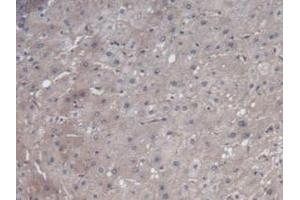 Detection of VEGF121 in Human Liver Tissue using Monoclonal Antibody to Vascular Endothelial Growth Factor 121 (VEGF121) (VEGF121 antibody  (AA 28-147))