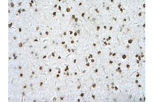 Immunohistochemistry (IHC) image for anti-Homeodomain Interacting Protein Kinase 2 (HIPK2) (Middle Region) antibody (ABIN2779735)