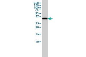 RLBP1 monoclonal antibody (M02), clone 4H5 Western Blot analysis of RLBP1 expression in HepG2 . (RLBP1 antibody  (AA 1-317))