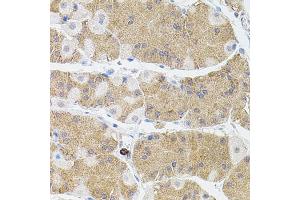 Immunohistochemistry of paraffin-embedded human stomach using MMP9 antibody (ABIN4904399) at dilution of 1:100 (40x lens).