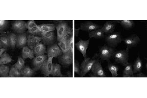 Immunofluorescent staining of A549 (ATCC CCL-185) cells. (NF-kB p65 antibody  (AA 136-224))