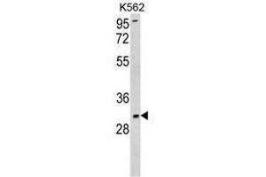 Western blot analysis of SOD3 Antibody (N-term) in K562 cell line lysates (35ug/lane).