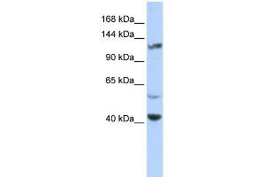 WB Suggested Anti-KCNH3 Antibody Titration:  0. (KCNH3 antibody  (Middle Region))