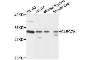 Western blot analysis of extracts of various cells, using CLEC7A antibody. (CLEC7A antibody)