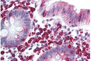 Colon, lamina propria plasma cells (LTK antibody  (AA 800-864))