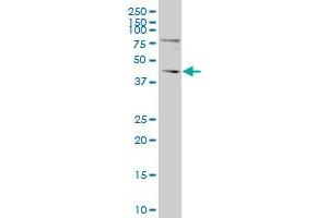 TGIF polyclonal antibody (A01), Lot # 051017JC01 Western Blot analysis of TGIF expression in Y-79 . (TGIF1 antibody  (AA 163-272))