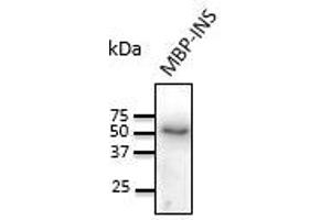 Anti-INS Ab at 1/1,000 dilution,, 20 ng of recombinant protein per Iane, rabblt polyclonal to goat lgG (HRP) at 1/10,000 dllution, (Insulin antibody)