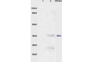 SDS-PAGE (SDS) image for anti-Epithelial Cell Adhesion Molecule (EPCAM) (AA 53-150) antibody (ABIN670611)