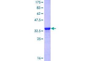 LAMA3 Protein (AA 29-138) (GST tag)