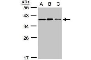 WB Image Sample(30 ug whole cell lysate) A:H1299 B:HeLa S3, C:Hep G2 , 12% SDS PAGE antibody diluted at 1:3000 (C9orf78 antibody)