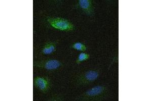 anti-Matrix Metallopeptidase 10 (Stromelysin 2) (MMP10) (AA 239-476) antibody