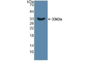 Detection of Recombinant DKK1, Human using Polyclonal Antibody to Dickkopf Related Protein 1 (DKK1) (DKK1 antibody  (AA 33-266))
