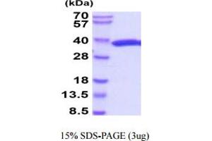 Luciferase Protein (AA 1-311) (His tag)