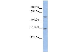 WB Suggested Anti-KCNIP2 Antibody Titration:  0. (KCNIP2 antibody  (Middle Region))