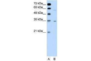 GPCR5A antibody used at 1 ug/ml to detect target protein.