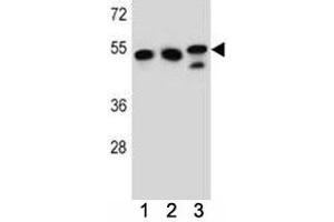 TUBB6 antibody western blot analysis in K562, HeLa, MDA-MB231 lysate. (TUBb6 antibody  (AA 139-166))