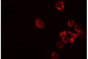 ABIN6278552 staining Hela cells by IF/ICC. (ARAF antibody  (Internal Region))