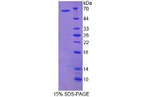 SDS-PAGE analysis of Mouse HRG Protein. (HRG Protein)