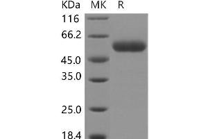 Western Blotting (WB) image for serine Carboxypeptidase 1 (SCPEP1) protein (His tag) (ABIN7320022) (SCPEP1 Protein (His tag))